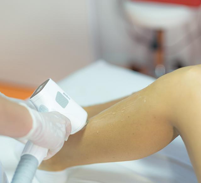 épilation sur mesure